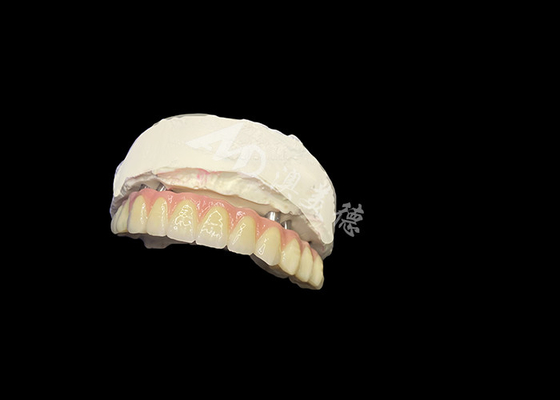 acheter Prothèses dentaires implantées Stabilité Confort et sourire naturel online manufacture