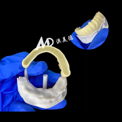 acheter Pont d'implantation provisoire PMMA avec une cavité à l'intérieur pour la stabilité et la cicatrisation naturelle, fabrication CAD/CAM de haute précision, matériau PMMA biocompatible online manufacture