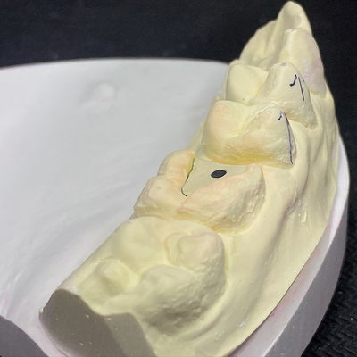 acheter Renforcez votre restauration grâce à la technologie Lock Pink Post Core online manufacture