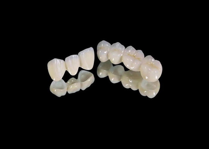 Couronne dentaire en zirconium résistant à l'usure avec résistance aux fissures et aux taches et esthétique naturelle du laboratoire dentaire chinois