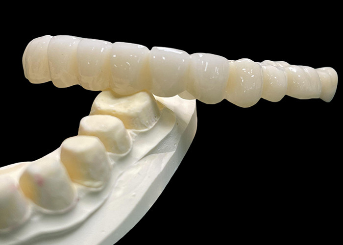 Vita Classique All Ceramic Crown Bridge naturel à la recherche de la restauration dentaire
