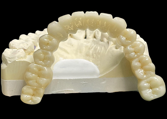 Vita Classique All Ceramic Crown Bridge naturel à la recherche de la restauration dentaire