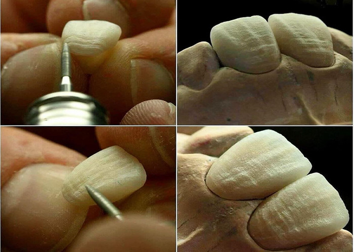 Durable résistant à l'usure Résistance à l'usure Tout le pont de couronne en céramique avec une excellente biocompatibilité pour la restauration dentaire