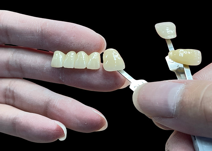 Résistant aux taches Tout pont en porcelaine Confortable Adapté à la restauration dentaire