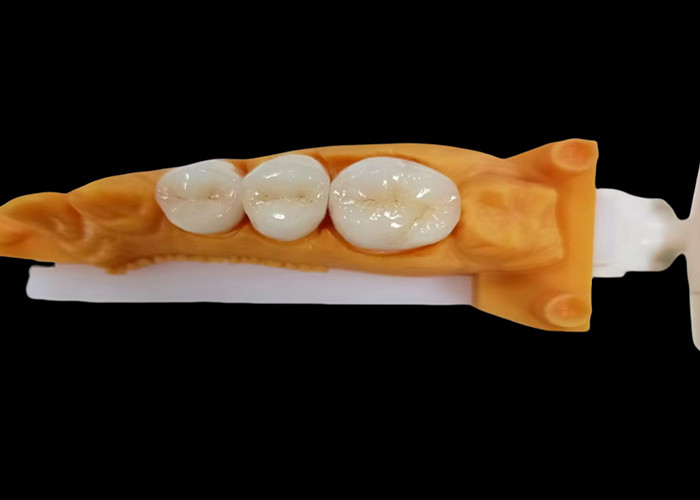 Couronne dentaire en zirconium résistant à l'usure avec résistance aux fissures et aux taches et esthétique naturelle du laboratoire dentaire chinois