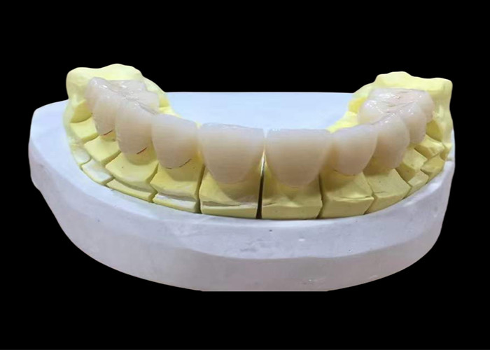 Couronne dentaire en porcelaine de zirconia avec une finition esthétique et naturelle du laboratoire dentaire chinois