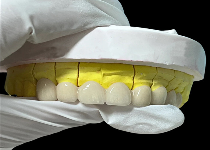 Couronne dentaire en porcelaine de zirconia avec une finition esthétique et naturelle du laboratoire dentaire chinois