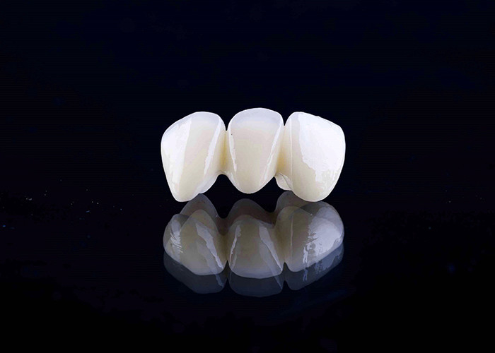 Couronne dentaire en porcelaine de zirconia avec une finition esthétique et naturelle du laboratoire dentaire chinois