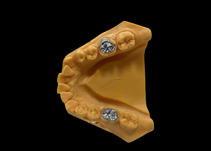 Porcelaine fondue dans le métal PFM Couronne Dentistique résistante à l'usure pour la dentisterie restauratrice