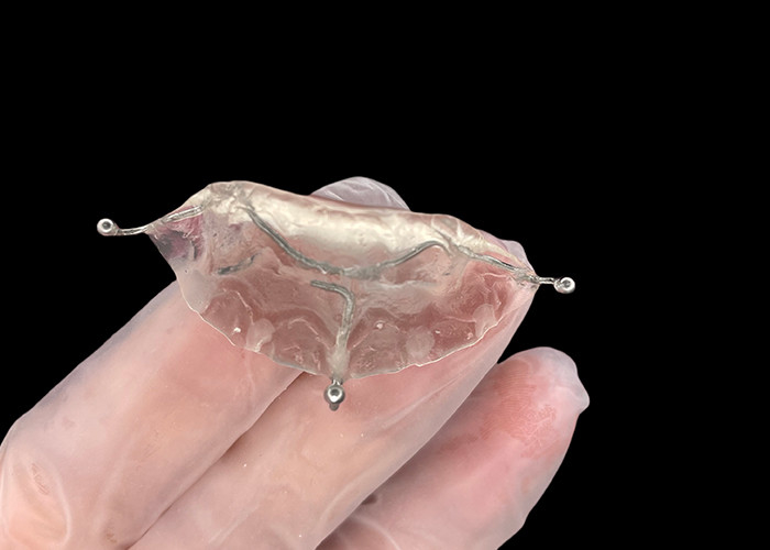 Appareils orthodontiques sur mesure pour le plan de morsure pour corriger les problèmes de morsure ou pour soulager la pression sur l'articulation de la mâchoire.
