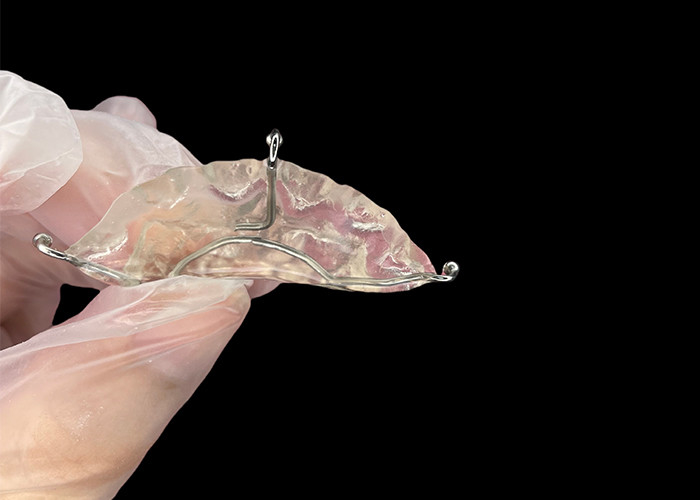 Appareils orthodontiques sur mesure pour le plan de morsure pour corriger les problèmes de morsure ou pour soulager la pression sur l'articulation de la mâchoire.
