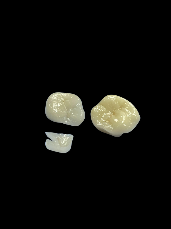 Porcelaine hypoallergénique encrés encrés pour les dents, couleur naturelle et entretien facile