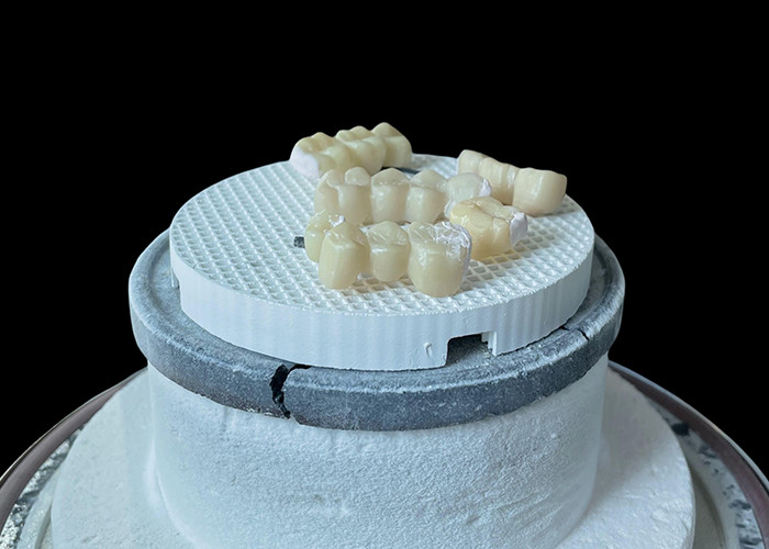 Pont dentaire en porcelaine confortable avec une construction entièrement en céramique pour une résistance à l'usure exceptionnelle