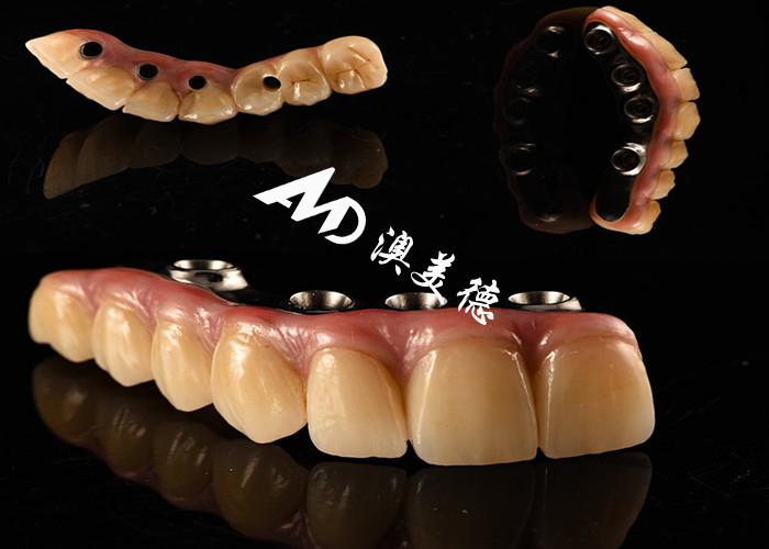 Implantation dentaire naturelle pont de couronne fixé avec un piédestal en titane pour la chirurgie des dents manquantes