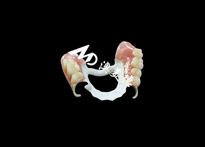 Prothèse amovible avec cadre HPP et base acrylique pour une durabilité et un confort améliorés