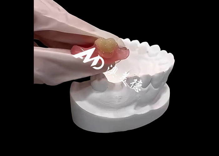 Les prothèses flexibles Nesbite offrent une solution sans couture pour un sourire confortable et naturel.