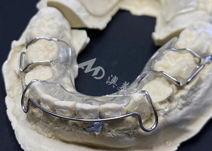 Confortable à porter Le rétenteur Hawley du laboratoire dentaire AMD pour une orthodontie sûre et saine