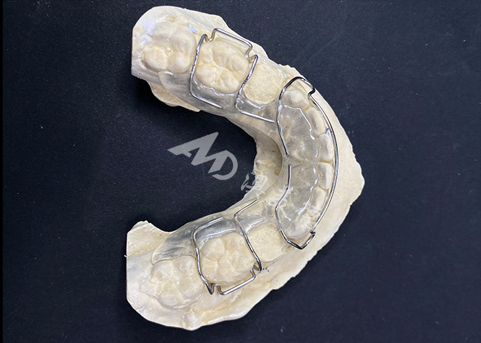 Appareils orthodontiques pour une correction confortable de l'alignement des dents
