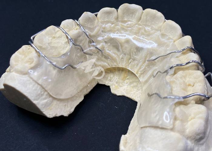 Appareils orthodontiques pour une correction confortable de l'alignement des dents