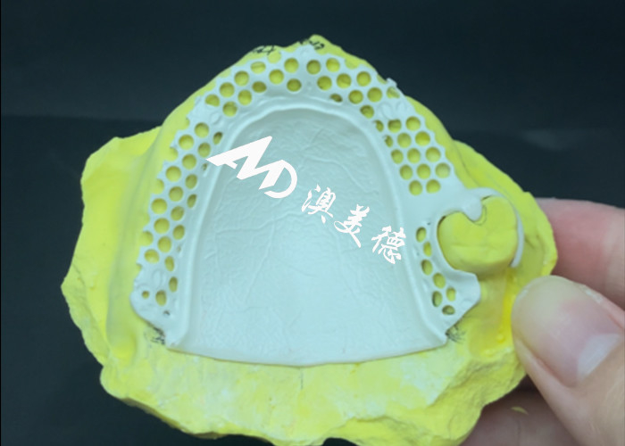 Rameau de prothèses dentaires amovibles HPP Adaptation personnalisée pour un fonctionnement optimal, confort et esthétique