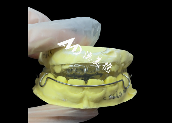 Activateurs orthodontiques polyvalents: la solution ultime pour l'alignement et la croissance de la mâchoire