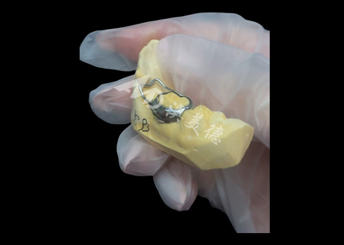 Le maintien de l'espace orthodontique est un dispositif inestimable qui protège ingénieusement les espaces entre les dents des enfants, assurant un bon développement des dents.