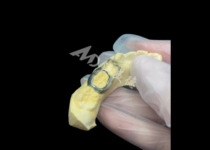 Le maintien de l'espace orthodontique est un dispositif inestimable qui protège ingénieusement les espaces entre les dents des enfants, assurant un bon développement des dents.