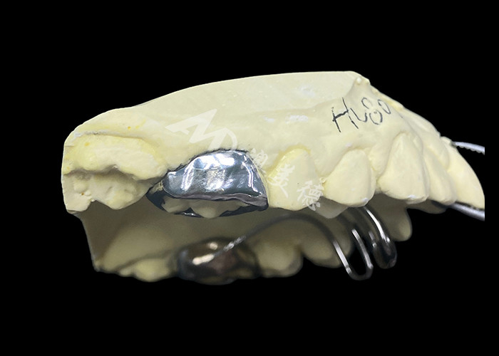 Appareil d'orthodontie utilisé pour traiter les problèmes de poussée de la langue et aider à l'alignement correct des dents
