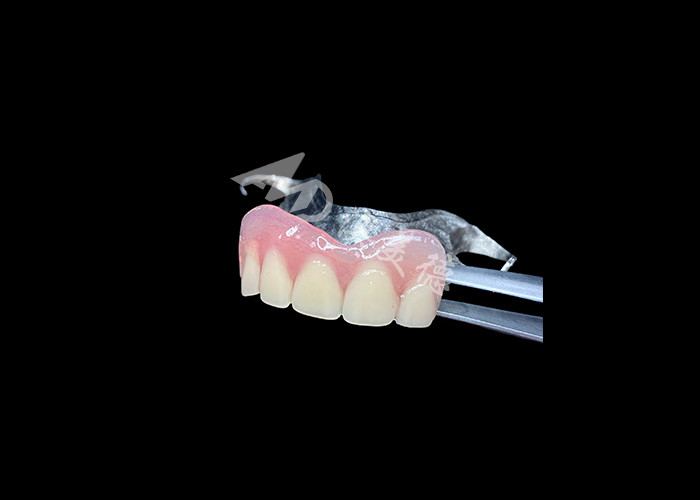 Prothèses dentaires partielles coulées durables Facile entretien pour une meilleure mastication et un sourire parfait