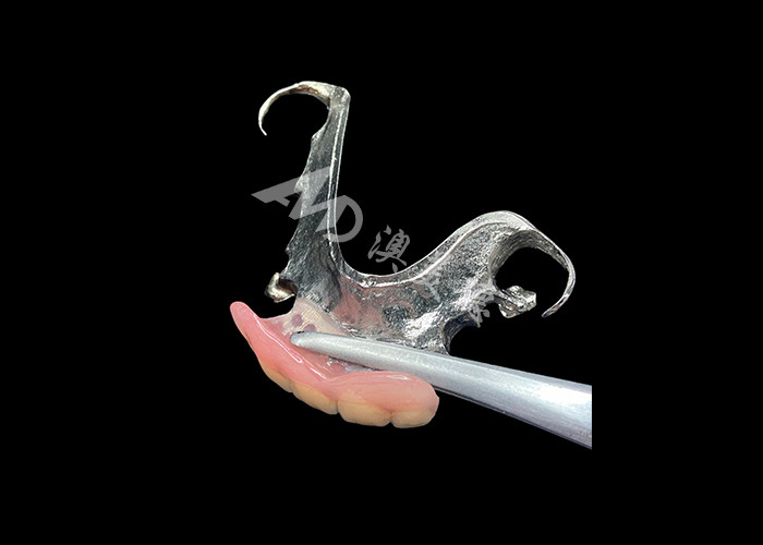 Prothèses dentaires partielles coulées durables Facile entretien pour une meilleure mastication et un sourire parfait