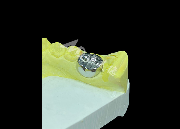Fonction durable Couronne en métal coulée durable pour une restauration dentaire supérieure