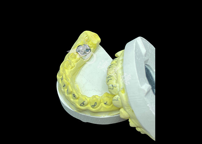 Fonction durable Couronne en métal coulée durable pour une restauration dentaire supérieure