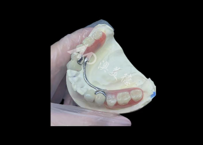Porcelaine durable fondue dans du métal couronne dentaire PFM couronne pour la restauration