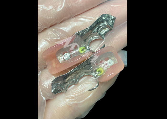 Dentures partielles coulées personnalisées cadre métallique de précision pour un ajustement et une fonctionnalité optimaux