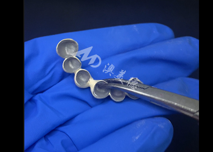 Porcelaine biocompatible fusionnée à une couronne métallique haute durabilité pour une restauration améliorée