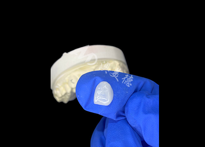IPS e.max Veneurs pour incisif à l'ombre A1 Esthétique naturelle pour un sourire parfait