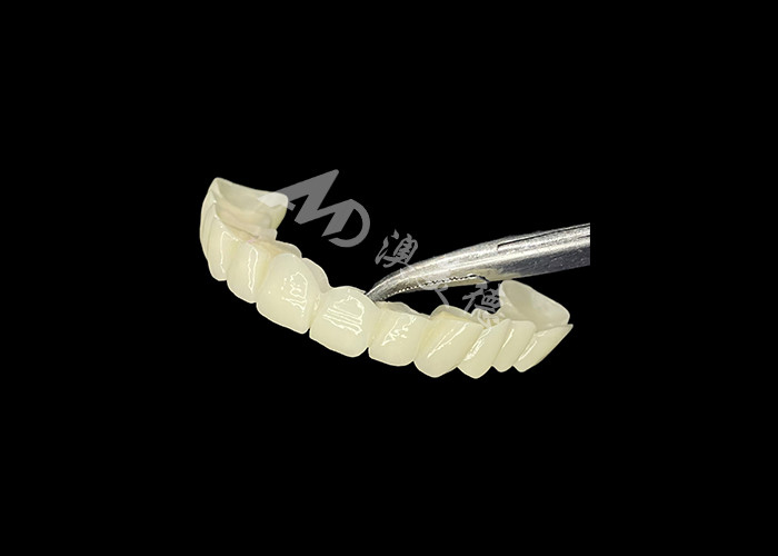 Pont dentaire en zirconium à haute translucide Forte et naturelle pour une restauration du sourire sans couture