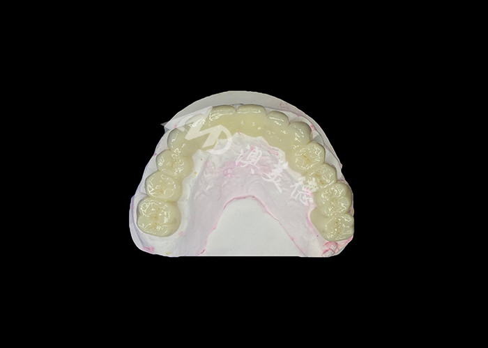 Pont dentaire en zirconium à haute translucide Forte et naturelle pour une restauration du sourire sans couture