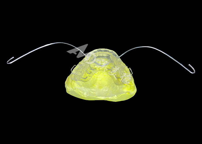 Appareil d'orthodontie esthétique activateur modifié Matériau durable pour un alignement efficace de la mâchoire
