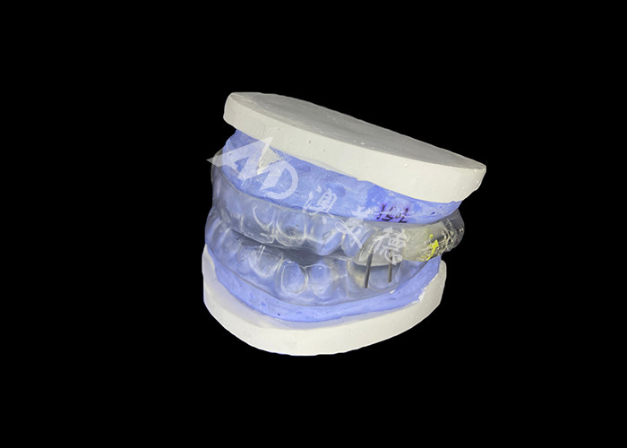 Dispositif anti-ronflement de requin Dispositif d'avancement mandibulaire réglable pour améliorer le soulagement du ronflement et l'amélioration du sommeil