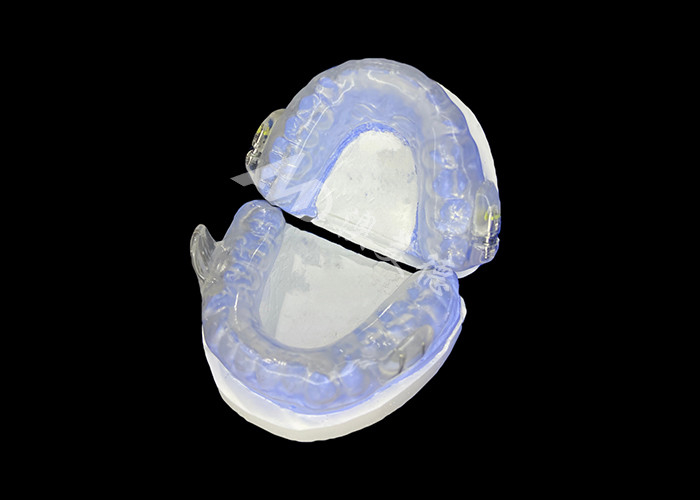 Dispositif anti-ronflement de requin Dispositif d'avancement mandibulaire réglable pour améliorer le soulagement du ronflement et l'amélioration du sommeil