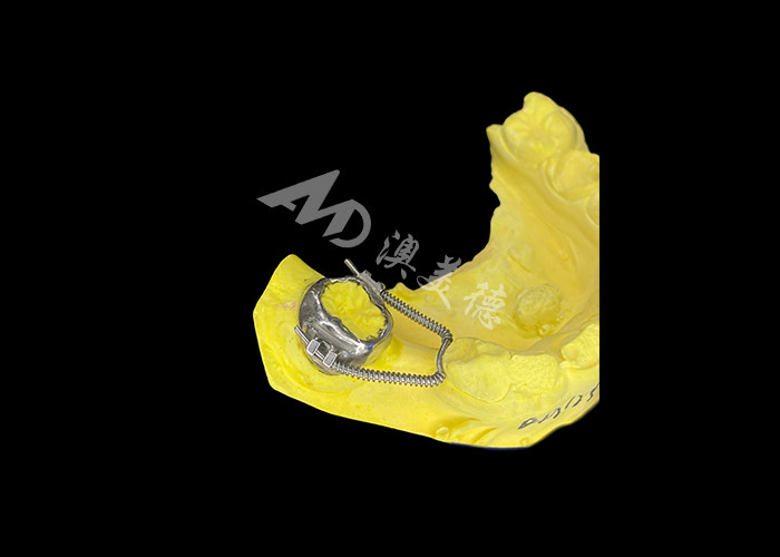 Régénérateur de boucle coulissante pour une récupération d'espace efficace et un mouvement dentaire précis pour atteindre un alignement optimal dans les traitements orthodontiques