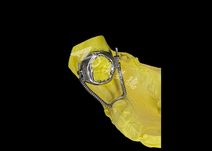 Régénérateur de boucle coulissante pour une récupération d'espace efficace et un mouvement dentaire précis pour atteindre un alignement optimal dans les traitements orthodontiques