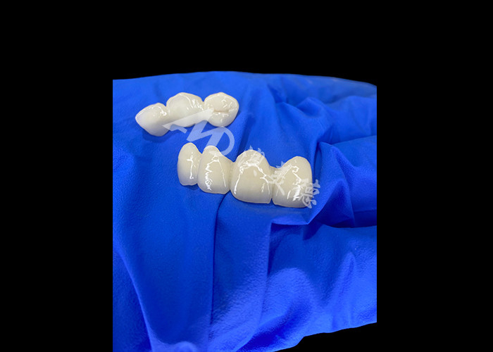Wieland Zenostar Ceramic Crown Bridge haute précision pour des restaurations durables et naturelles