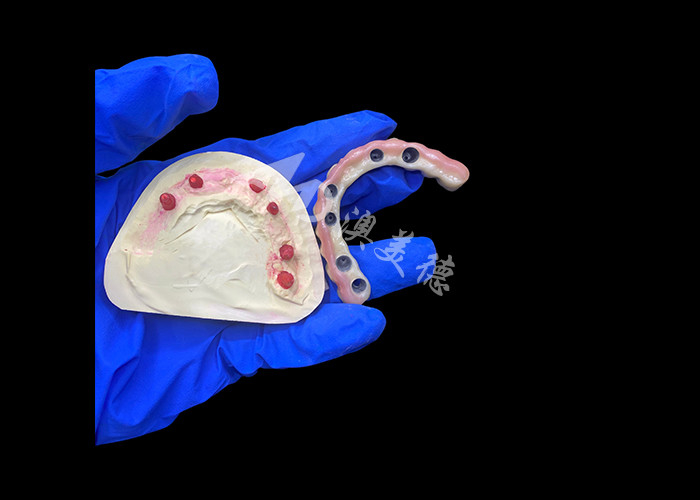 Dentures en titane et couronne en zirconium avec support d'implant Précision adaptée à un usage confortable