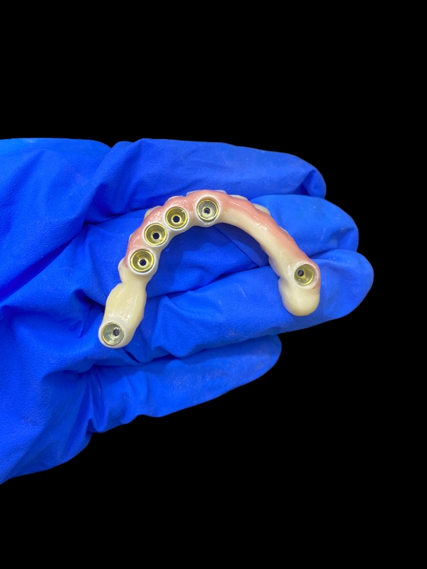 Dentures en titane et couronne en zirconium avec support d'implant Précision adaptée à un usage confortable