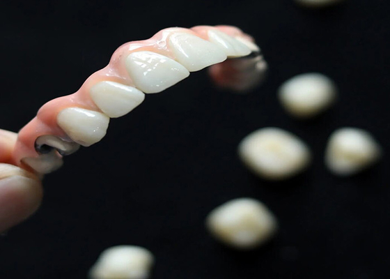 Bon prix Solution esthétique Implantation dentaire pont de couronne pour adultes remplaçant les dents manquantes en ligne