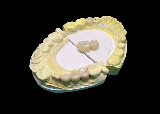 Bon prix Des couronnes et des ponts en céramique translucide améliorent votre sourire grâce à une esthétique naturelle et précise pour une durabilité durable en ligne