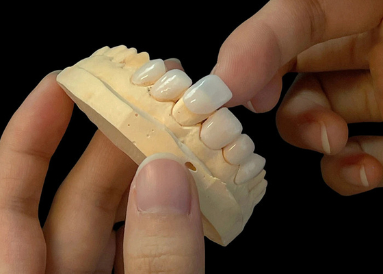 Bon prix Porcelaine de teinte ultra mince Veneers EMAX résistant aux taches pour les restaurations esthétiques en ligne