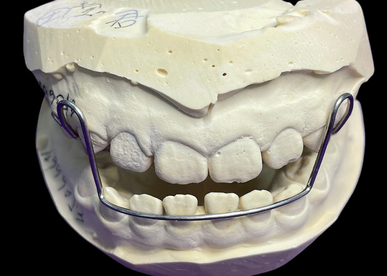 Bon prix Appareil d'arc de guidage Retenants orthodontiques Aligneurs avec une bonne rétention Prouvée commodité en ligne